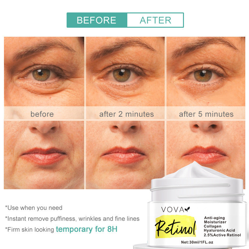 Anti-Aging Feuchtigkeitscreme mit Retinol 30g